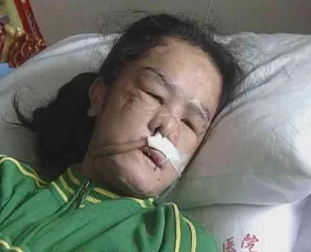 九游娱乐网站：人狠起来究竟有多可怕？15岁女孩受虐5年被利器撬掉所有牙齿！(图2)