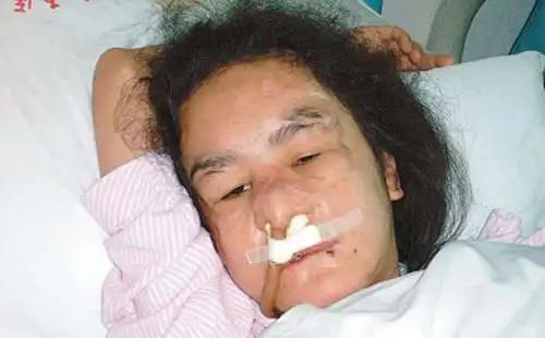 九游娱乐网站：人狠起来究竟有多可怕？15岁女孩受虐5年被利器撬掉所有牙齿！(图8)